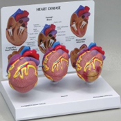 Mini Heart Set Models Pharmaceutical and Anatomical Model Gifts